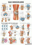 anat. Lehrtafel: Das Kniegelenk 70 x 100 cm, Papier